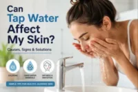 Can Tap Water Affect My Skin? Causes, Signs, and Solutions