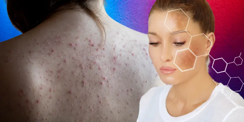 Dark Spots and Redness