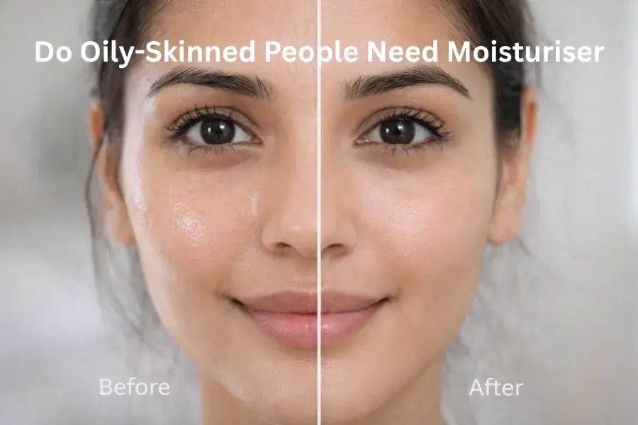 Do oily-skinned people need moisturiser before and after comparison showing hydrated vs oily skin