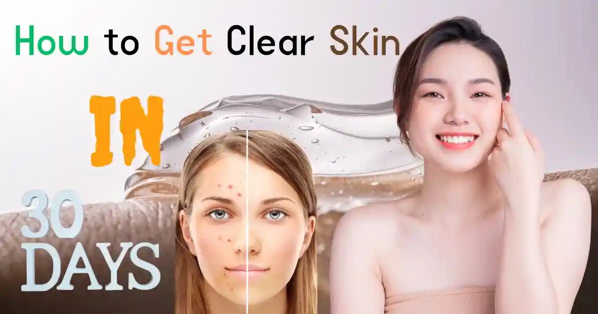 Clear Skin in 30 Days - Proven Tips and Remedies