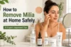 How to Remove Milia at Home Safely: 10 Expert-Approved Tips - Post Thumbnail