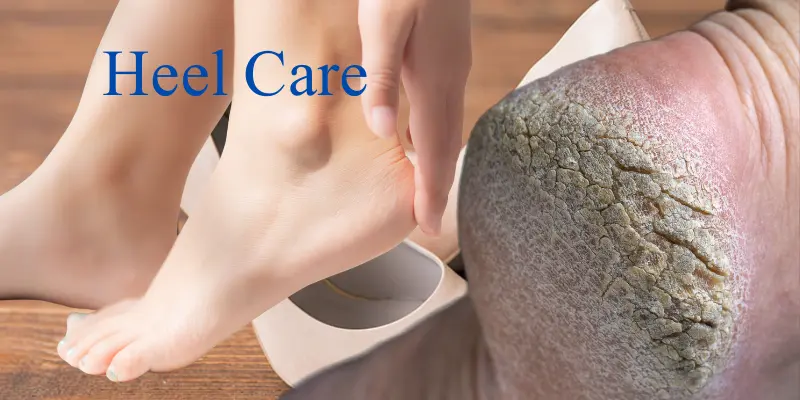 Visual representation of heel care tips for winter, summer, rainy season, and transitional weather showing soft, well-maintained heels