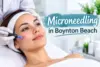 What to Know Before Choosing Microneedling in Boynton Beach - Post Thumbnail