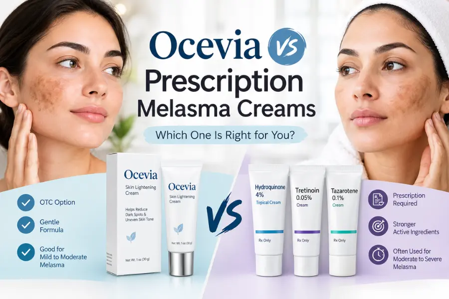Ocevia vs prescription melasma creams comparison featuring OTC and prescription treatment options for reducing melasma and dark spots.