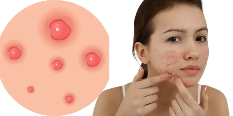  Skin Break and Its Causes