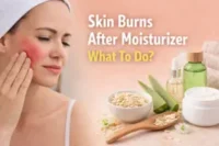 Skin Burns After Moisturizer What To Do: Causes, Relief & Prevention