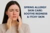 Spring Allergy Skin Care Tips: Soothe Redness and Itchy Skin Naturally - Post Thumbnail