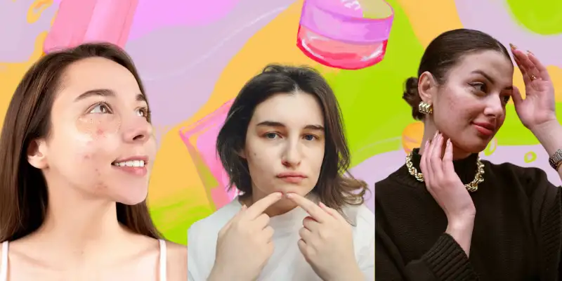 3 Girls faces with skin Disease